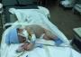 Հայաստանում առաջին անգամ նորածինը վիրահատվել է էնդոսկոպիկ եղանակով