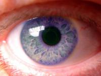 Իմունային թերապիան կարող օգնել՝ ազատվելու աչքի հիվանդություններից